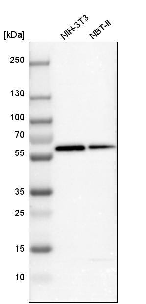 Vitamin D BP Antibody - BSA Free Western Blot: Vitamin D BP Antibody - BSA Free [NBP1-88027]
