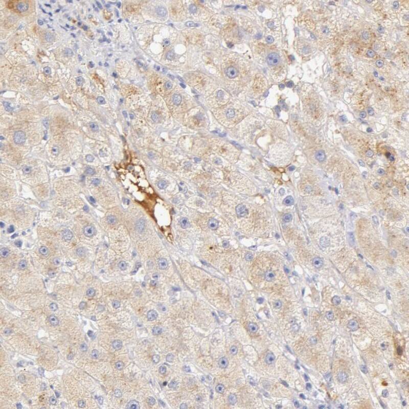 Vitamin D BP Antibody - BSA Free Immunohistochemistry-Paraffin: Vitamin D BP Antibody [NBP1-88028]