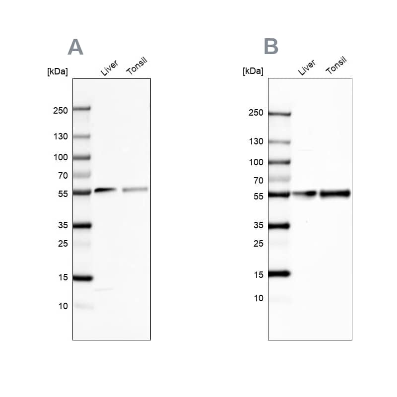 Vitamin D BP Antibody - BSA Free Western Blot: Vitamin D BP Antibody - BSA Free [NBP1-88028]