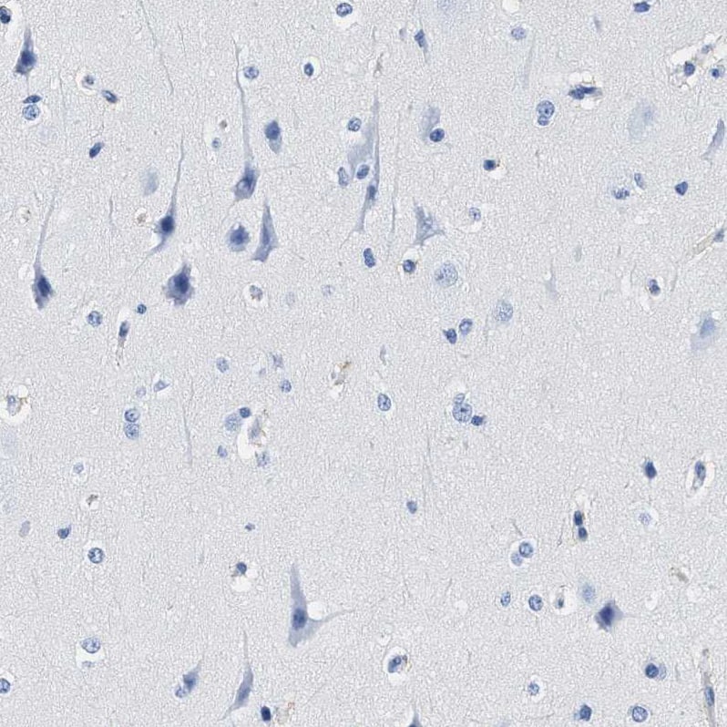 Cerberus 1 Antibody - BSA Free Immunohistochemistry-Paraffin: Cerberus 1 Antibody - BSA Free [NBP1-88030]