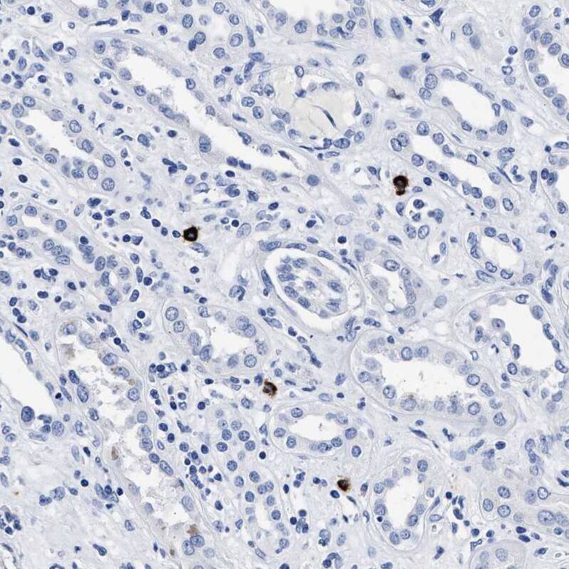 Cerberus 1 Antibody - BSA Free Immunohistochemistry-Paraffin: Cerberus 1 Antibody - BSA Free [NBP1-88030]