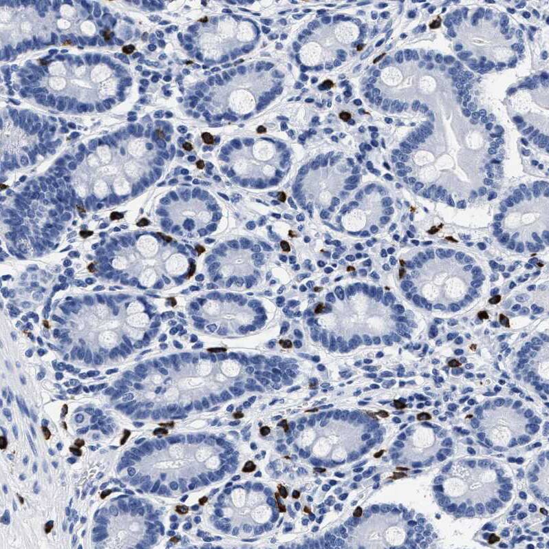 Cerberus 1 Antibody - BSA Free Immunohistochemistry-Paraffin: Cerberus 1 Antibody - BSA Free [NBP1-88030]