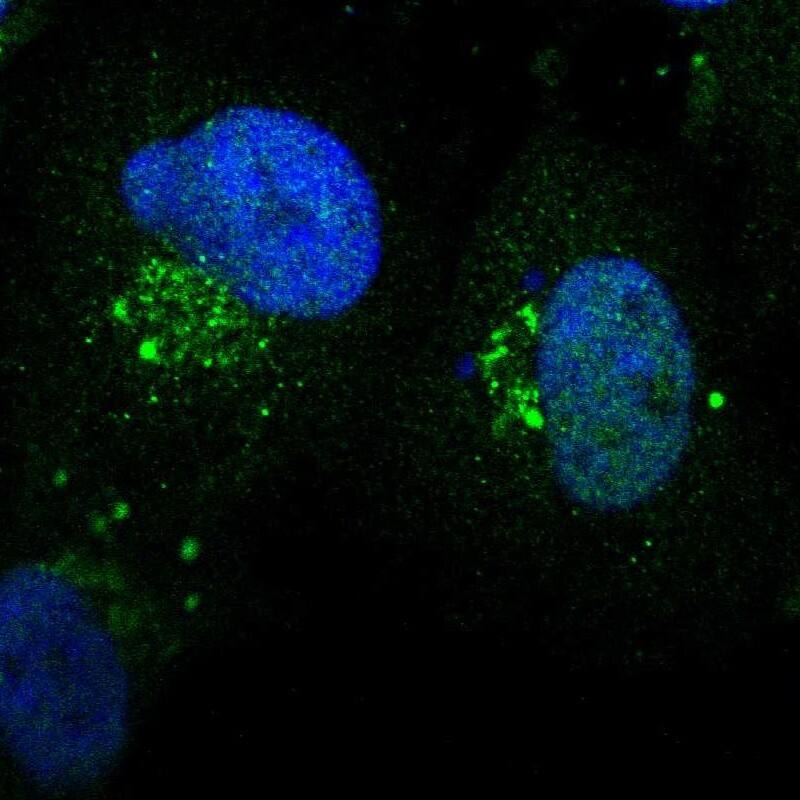 ZNF75 Antibody - BSA Free Immunocytochemistry/ Immunofluorescence: ZNF75 Antibody [NBP1-88035]