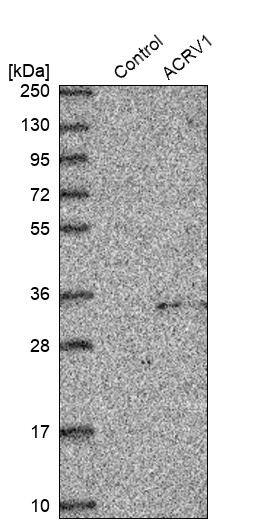 Intra Acrosomal Protein Antibody - BSA Free Western Blot: Intra Acrosomal Protein Antibody - BSA Free [NBP1-88038]