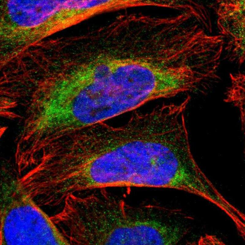 Cytochrome b5 Outer Mitochondrial Membrane Antibody - BSA Free Immunocytochemistry/ Immunofluorescence: Cytochrome b5 Outer Mitochondrial Membrane Antibody [NBP1-88039]