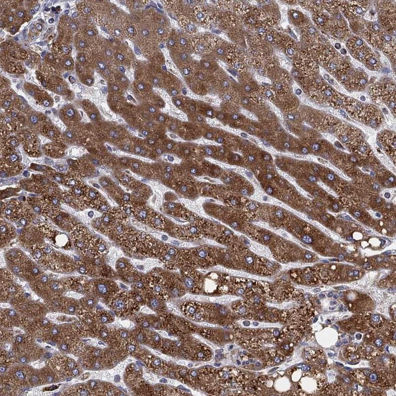Cytochrome b5 Outer Mitochondrial Membrane Antibody - BSA Free Immunohistochemistry-Paraffin: Cytochrome b5 Outer Mitochondrial Membrane Antibody - BSA Free [NBP1-88039]
