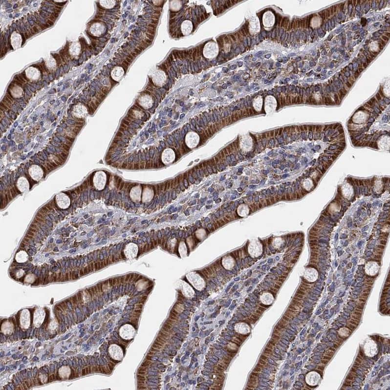 Cytochrome b5 Outer Mitochondrial Membrane Antibody - BSA Free Immunohistochemistry-Paraffin: Cytochrome b5 Outer Mitochondrial Membrane Antibody - BSA Free [NBP1-88039]