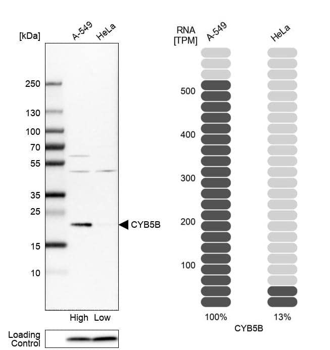 Cytochrome b5 Outer Mitochondrial Membrane Antibody - BSA Free Western Blot: Cytochrome b5 Outer Mitochondrial Membrane Antibody - BSA Free [NBP1-88039]