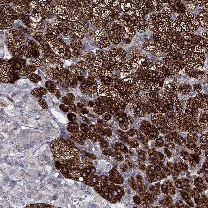 Cytochrome b5 Outer Mitochondrial Membrane Antibody - BSA Free Immunohistochemistry-Paraffin: Cytochrome b5 Outer Mitochondrial Membrane Antibody - BSA Free [NBP1-88039]