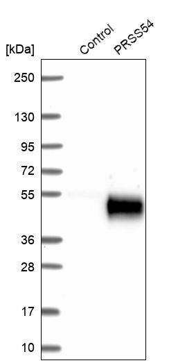 Klkbl4 Antibody - BSA Free Western Blot: Klkbl4 Antibody - BSA Free [NBP1-88043]