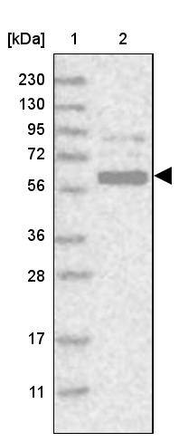 CT110 Antibody - BSA Free Western Blot: CT110 Antibody - BSA Free [NBP1-88045]