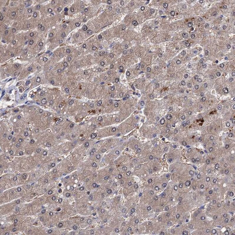 CSTP1 Antibody - BSA Free Immunohistochemistry-Paraffin: CSTP1 Antibody - BSA Free [NBP1-88048]