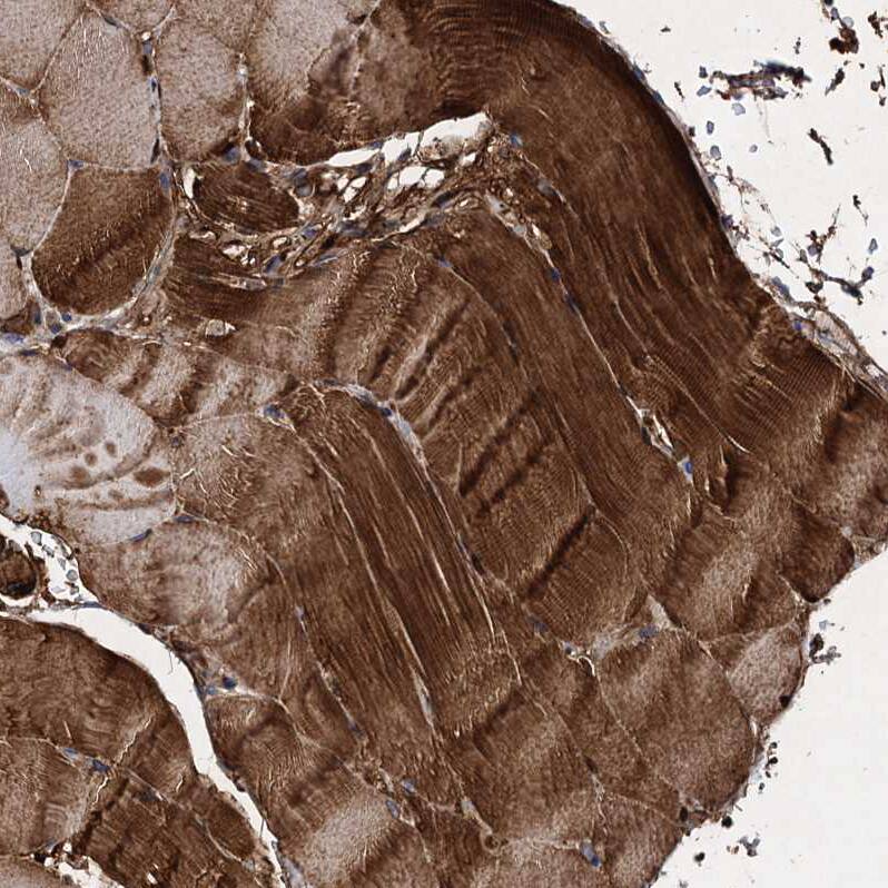CSTP1 Antibody - BSA Free Immunohistochemistry-Paraffin: CSTP1 Antibody - BSA Free [NBP1-88048]
