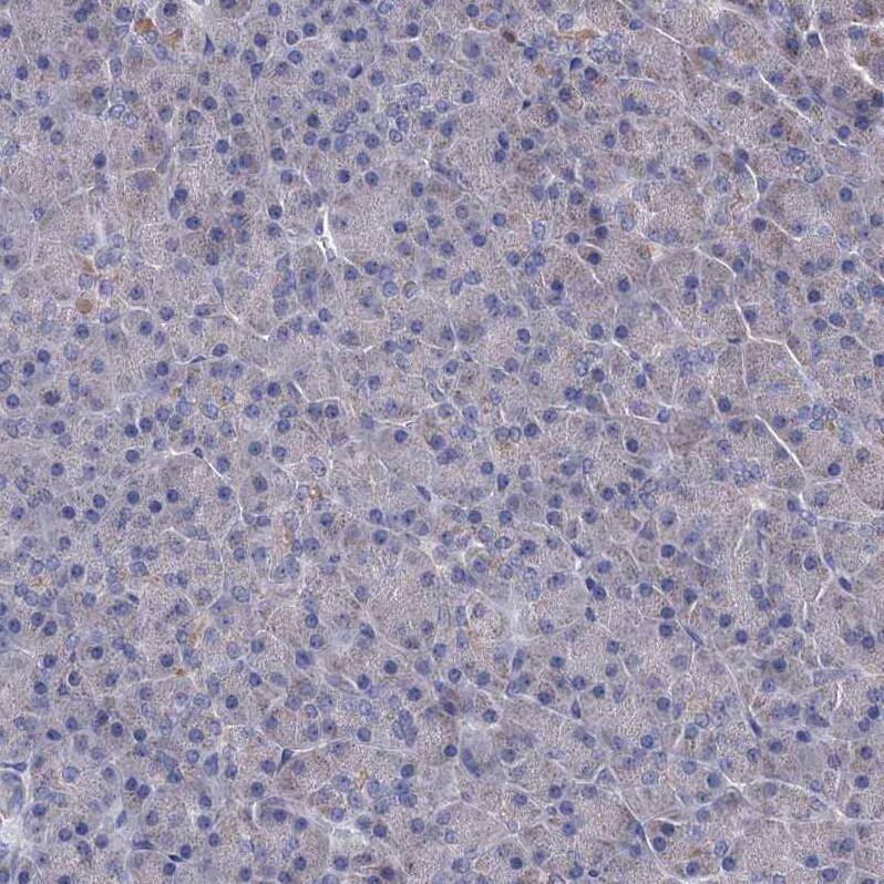 CSTP1 Antibody - BSA Free Immunohistochemistry-Paraffin: CSTP1 Antibody - BSA Free [NBP1-88048]