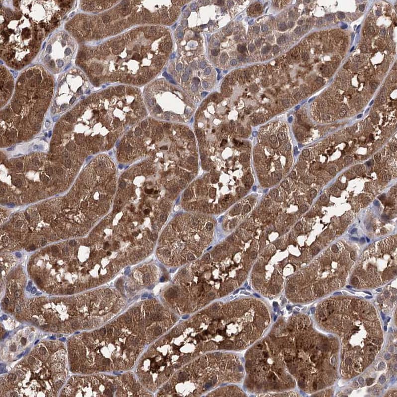 CSTP1 Antibody - BSA Free Immunohistochemistry-Paraffin: CSTP1 Antibody - BSA Free [NBP1-88048]