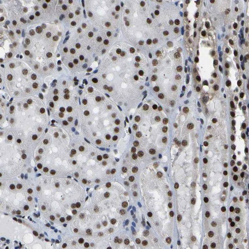 CROP Antibody - BSA Free Immunohistochemistry-Paraffin: CROP Antibody - BSA Free [NBP1-88051]