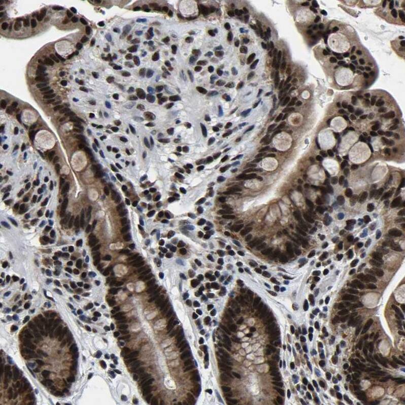 CROP Antibody - BSA Free Immunohistochemistry-Paraffin: CROP Antibody - BSA Free [NBP1-88051]