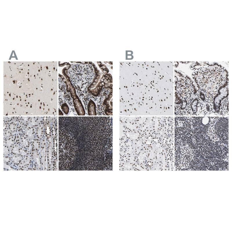 CROP Antibody - BSA Free Immunohistochemistry-Paraffin: CROP Antibody - BSA Free [NBP1-88051]