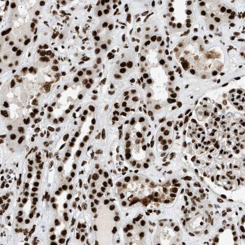 CROP Antibody - BSA Free Immunohistochemistry-Paraffin: CROP Antibody - BSA Free [NBP1-88052]