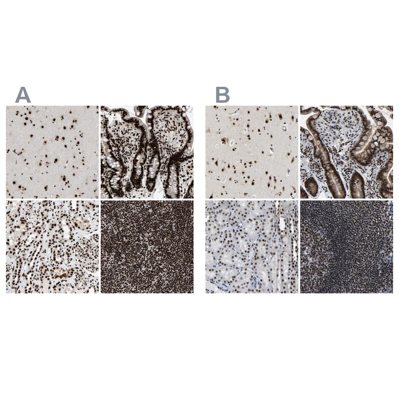 CROP Antibody - BSA Free Immunohistochemistry-Paraffin: CROP Antibody - BSA Free [NBP1-88052]