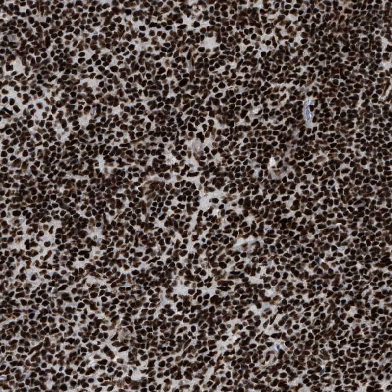 CROP Antibody - BSA Free Immunohistochemistry-Paraffin: CROP Antibody - BSA Free [NBP1-88052]