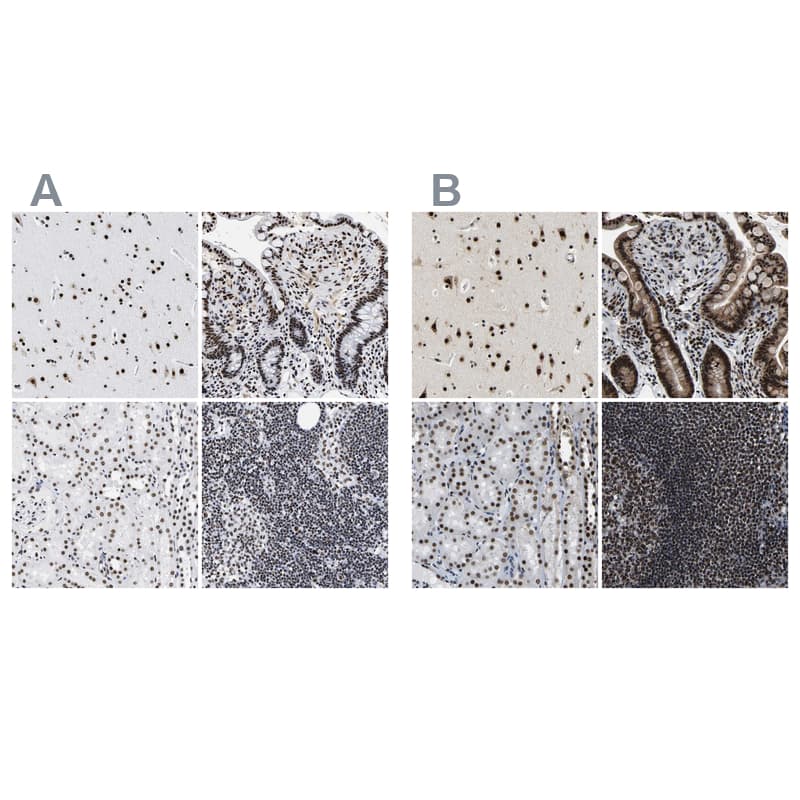 CROP Antibody - BSA Free Immunohistochemistry-Paraffin: CROP Antibody - BSA Free [NBP1-88053]