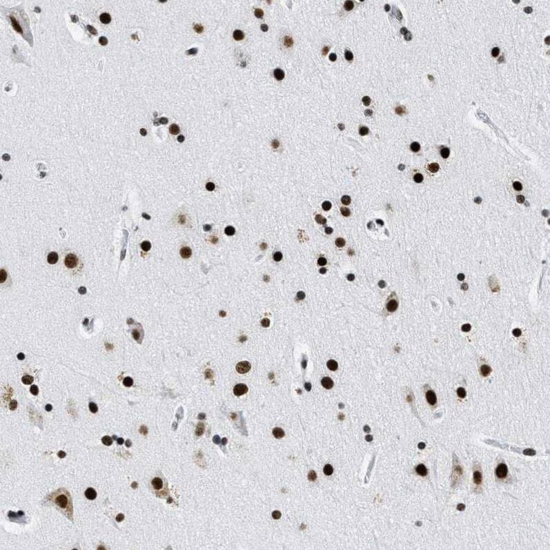CROP Antibody - BSA Free Immunohistochemistry-Paraffin: CROP Antibody - BSA Free [NBP1-88053]