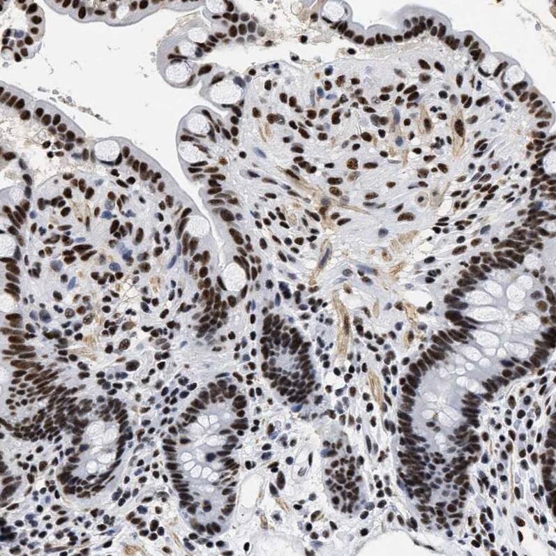 CROP Antibody - BSA Free Immunohistochemistry-Paraffin: CROP Antibody - BSA Free [NBP1-88053]