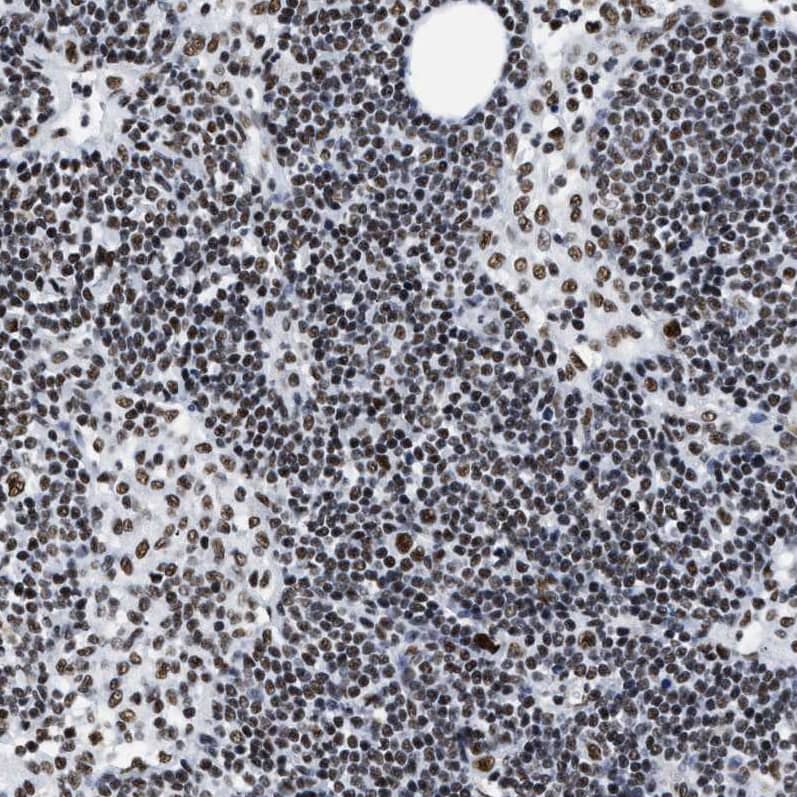 CROP Antibody - BSA Free Immunohistochemistry-Paraffin: CROP Antibody - BSA Free [NBP1-88053]