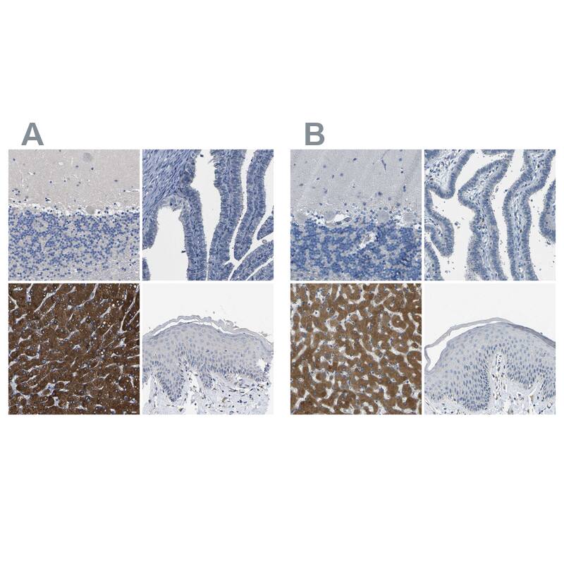 Cytochrome P450 2C8 Antibody - BSA Free Immunohistochemistry-Paraffin: Cytochrome P450 2C8 Antibody - BSA Free [NBP1-88054]