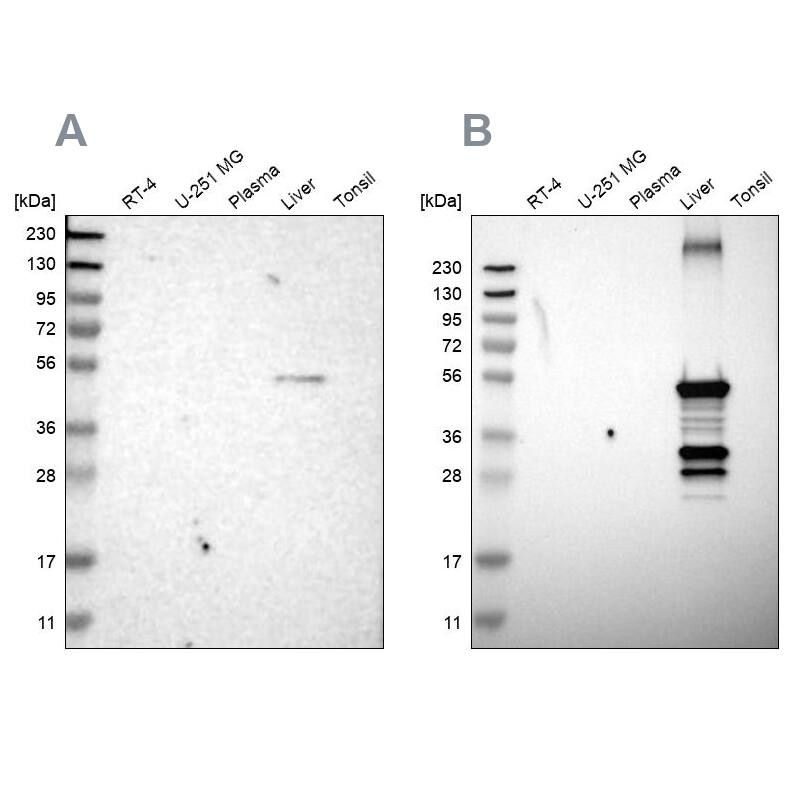 Cytochrome P450 2C8 Antibody - BSA Free Western Blot: Cytochrome P450 2C8 Antibody - BSA Free [NBP1-88055]