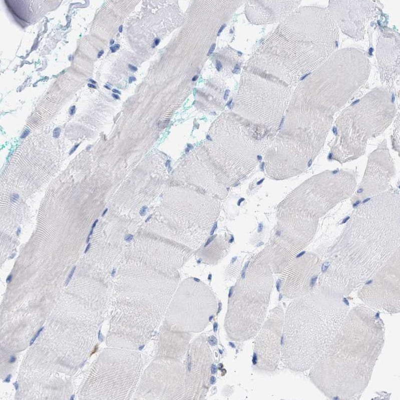 Plastin L Antibody - BSA Free Immunohistochemistry-Paraffin: Plastin L Antibody - BSA Free [NBP1-88057]