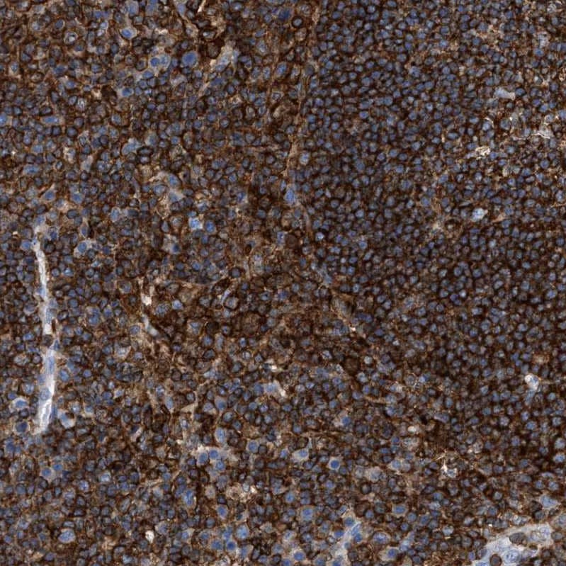 Plastin L Antibody - BSA Free Immunohistochemistry-Paraffin: Plastin L Antibody - BSA Free [NBP1-88057]