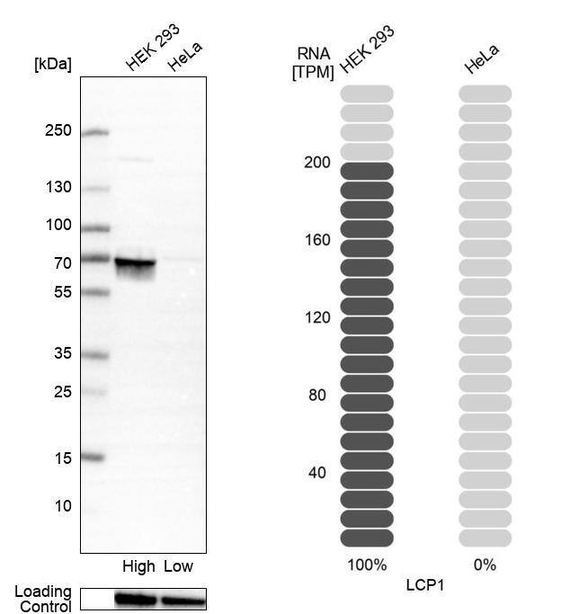 Plastin L Antibody - BSA Free Western Blot: Plastin L Antibody - BSA Free [NBP1-88057]