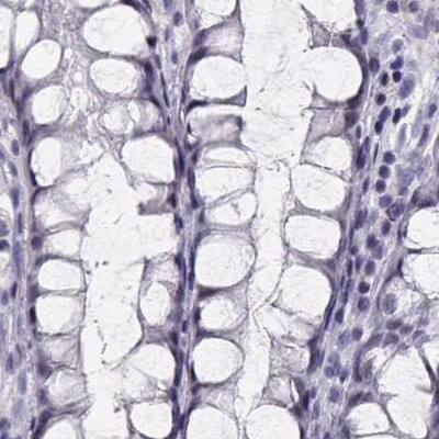CRX/CORD2 Antibody - BSA Free Immunohistochemistry-Paraffin: CRX/CORD2 Antibody - BSA Free [NBP1-88059]