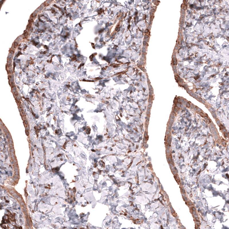 Collagen XII alpha1 Antibody - BSA Free Immunohistochemistry-Paraffin: Collagen XII alpha1 Antibody - BSA Free [NBP1-88062]
