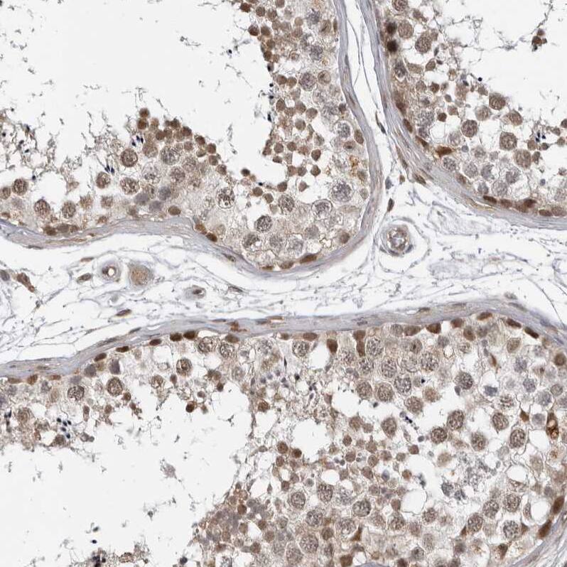 c-Maf Antibody - BSA Free Immunohistochemistry-Paraffin: c-Maf Antibody - BSA Free [NBP1-88072]