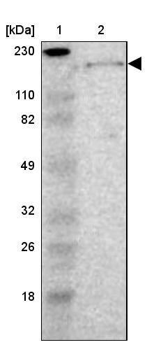 Laminin beta 1 Antibody - BSA Free Western Blot: Laminin beta 1 Antibody - BSA Free [NBP1-88073]