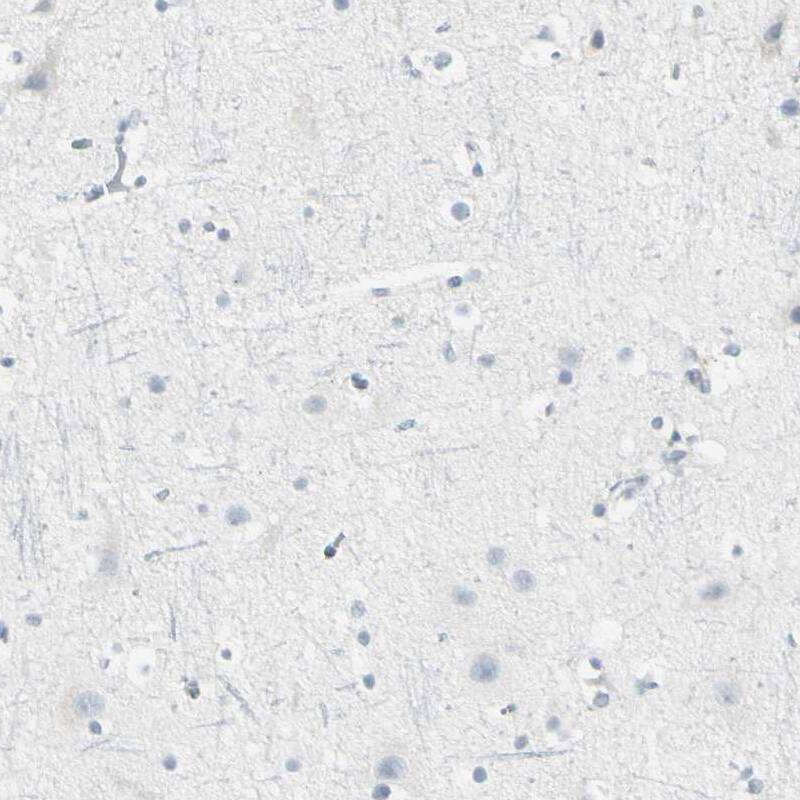Th-POK Antibody - BSA Free Immunohistochemistry-Paraffin: Th-POK Antibody - BSA Free [NBP1-88077]