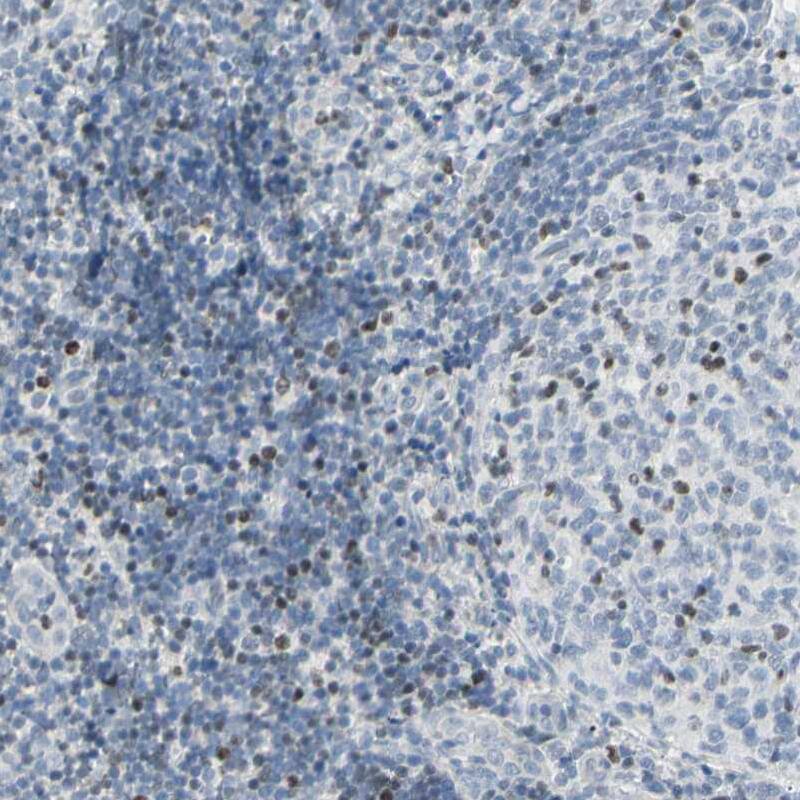 Th-POK Antibody - BSA Free Immunohistochemistry-Paraffin: Th-POK Antibody - BSA Free [NBP1-88077]