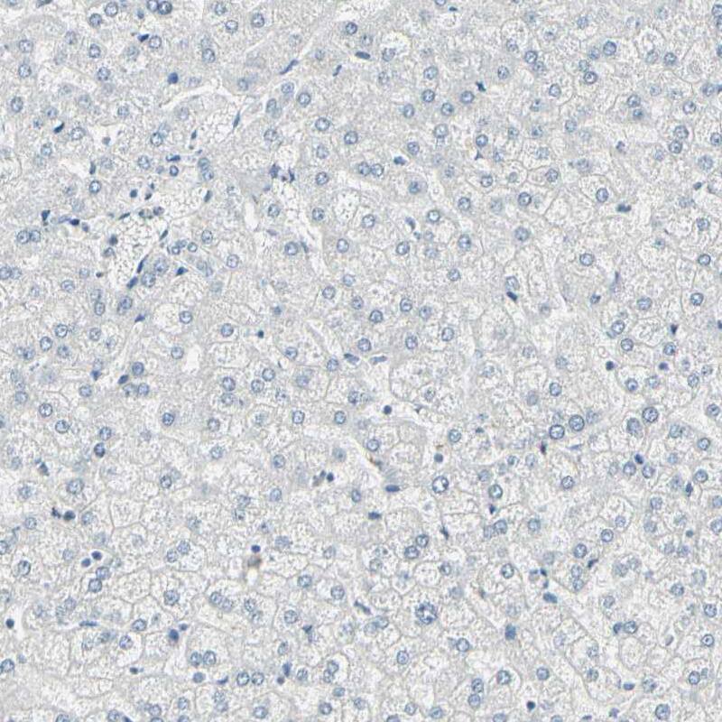 Th-POK Antibody - BSA Free Immunohistochemistry-Paraffin: Th-POK Antibody - BSA Free [NBP1-88077]