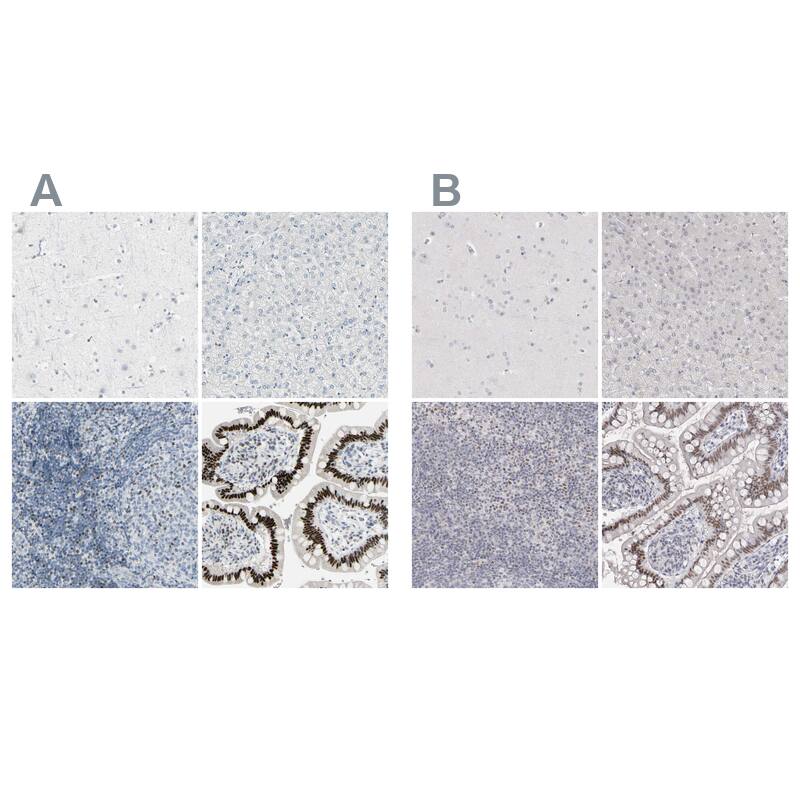 Th-POK Antibody - BSA Free Immunohistochemistry-Paraffin: Th-POK Antibody - BSA Free [NBP1-88077]