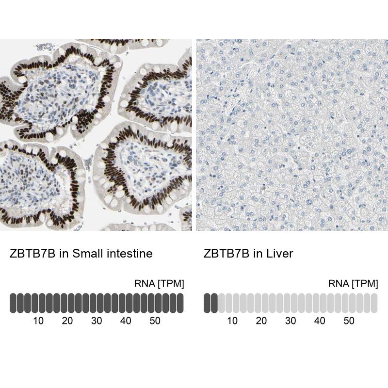 Th-POK Antibody - BSA Free Immunohistochemistry-Paraffin: Th-POK Antibody - BSA Free [NBP1-88077]
