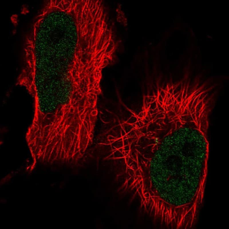 Th-POK Antibody - BSA Free Immunocytochemistry/ Immunofluorescence: Th-POK Antibody - BSA Free [NBP1-88078]