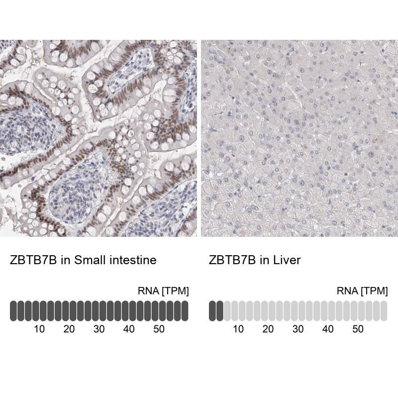 Th-POK Antibody - BSA Free Immunohistochemistry-Paraffin: Th-POK Antibody - BSA Free [NBP1-88078]