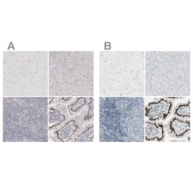 Th-POK Antibody - BSA Free Immunohistochemistry-Paraffin: Th-POK Antibody - BSA Free [NBP1-88078]