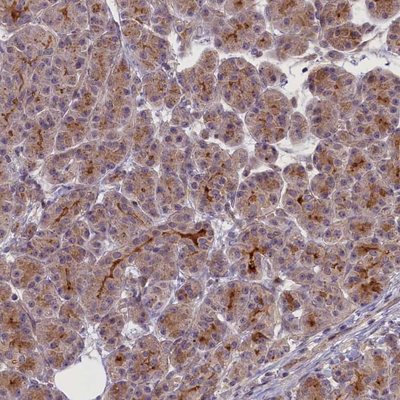 CCL23/Ck beta 8-1/MIP3 Antibody - BSA Free Immunohistochemistry-Paraffin: CCL23/Ck beta 8-1/MIP3 Antibody - BSA Free [NBP1-88079]
