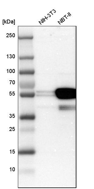Cytokeratin 7 Antibody - BSA Free Western Blot: Cytokeratin 7 Antibody - BSA Free [NBP1-88080]