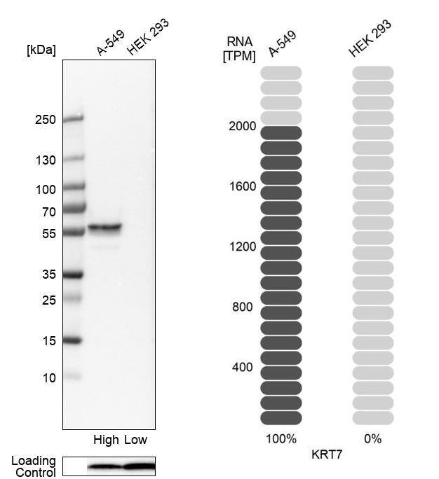 Cytokeratin 7 Antibody - BSA Free Western Blot: Cytokeratin 7 Antibody - BSA Free [NBP1-88080]