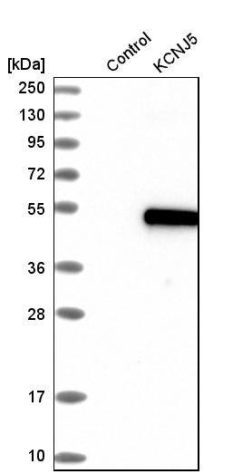 Kir3.4 Antibody - BSA Free Western Blot: Kir3.4 Antibody - BSA Free [NBP1-88081]